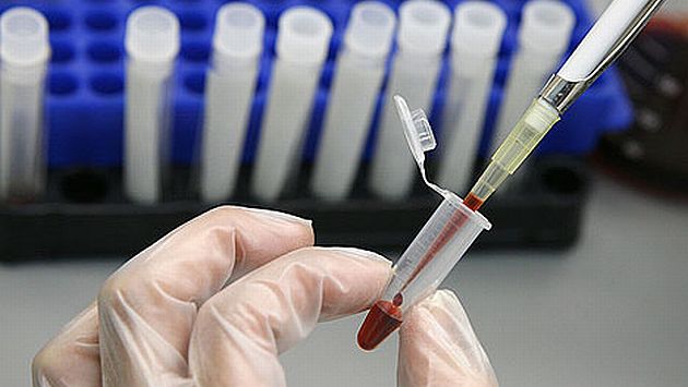 Científicos analizaron muestras de sangre de 226 personas de la tercera edad. (Internet)
